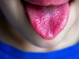 jagodičast jezik