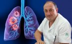 lečenje raka pluća