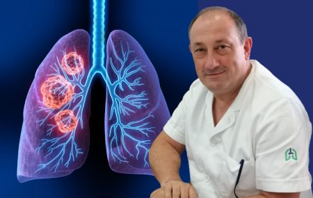 lečenje raka pluća