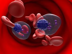 Izmenjene ćelije krvi koje daju multipli mijelom Foto: Shutterstock