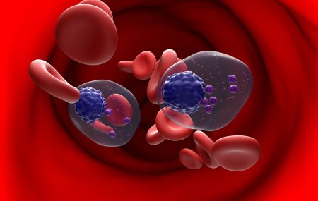 Izmenjene ćelije krvi koje daju multipli mijelom Foto: Shutterstock