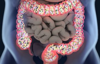 Kako rad creva i zdravlje mikrobioma utiču na razvoj nekih autoimunih bolesti