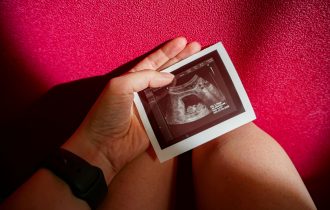 Novi test krvi može da objasni zašto se desio spontani pobačaj