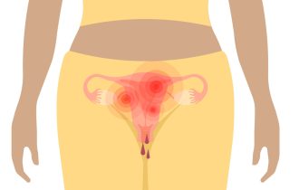 Ako ženu muče PMS problemi to može da bude najava rane manopauze, kažu naučnici