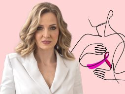 Doc. dr Ana Cvetanović Karcinom dojke