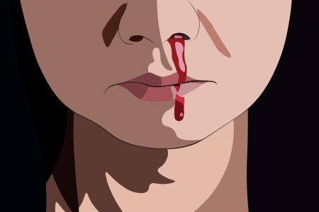 krvarenje iz nosa