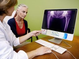 osteoartritis kuka