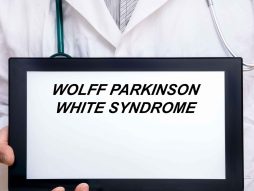 Wolff-Parkinson-White sindrom