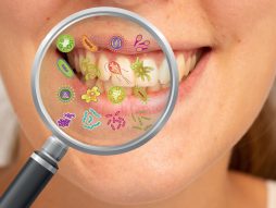 mikrobi u ustima