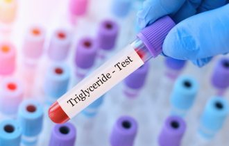 Visoki trigliceridi ili loš holesterol – Šta je opasnije