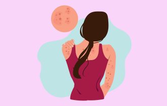 Alergija na kozmetičke proizvode: Koji sastojci najčešće iritiraju kožu?