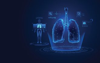 Bronhiektazije: Na šta može da ukaže produktivni kašalj kod nepušača