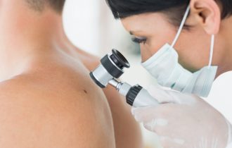 Besplatni pregledi kože počinju u manjim mestima u Srbiji