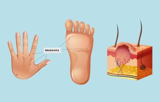 Bradavice na prstima i stopalima lako se šire i prenose, kako se najefikasnije leče
