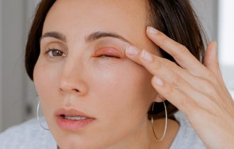 Po čemu se razlikuje očni herpes od čmička ili konjuktivitisa