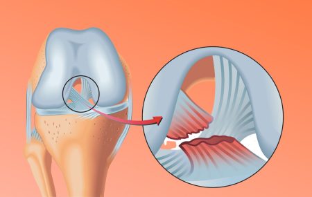 ligamenta kolena