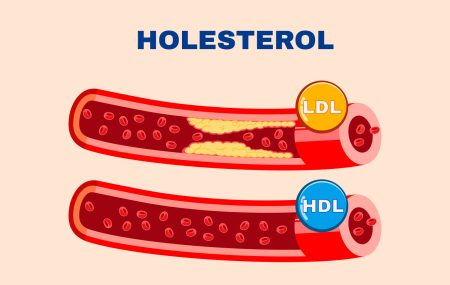 holesterol