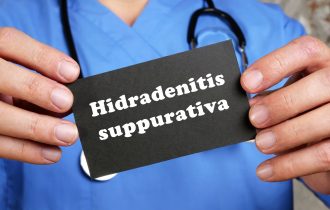 Nevidljiva patnja mladih: Hidradenitis suppurativa i borba sa hroničnim bolom