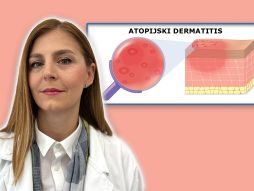 Atopijski dermatitis