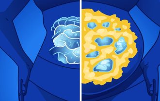 Skrivena masnoća u telu može da predvidi razvoj Alchajmerove bolesti 20 godina pre simptoma