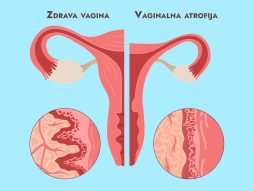 suvoća vagine