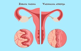 Najneprijatniji simptom menopauze o kome se uopšte ne govori: Sve o suvoći vagine i kako je rešiti