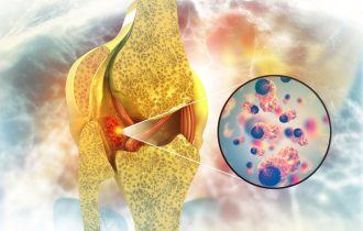 Odobren novi lek za retke tumore zglobova, koristi se kada bi operacija mogla da ošteti zglob